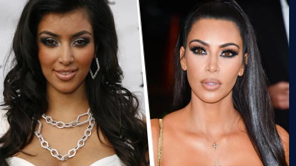 Kim Kardashian čvrsto stoji iza toga da nikad nije išla pod nož