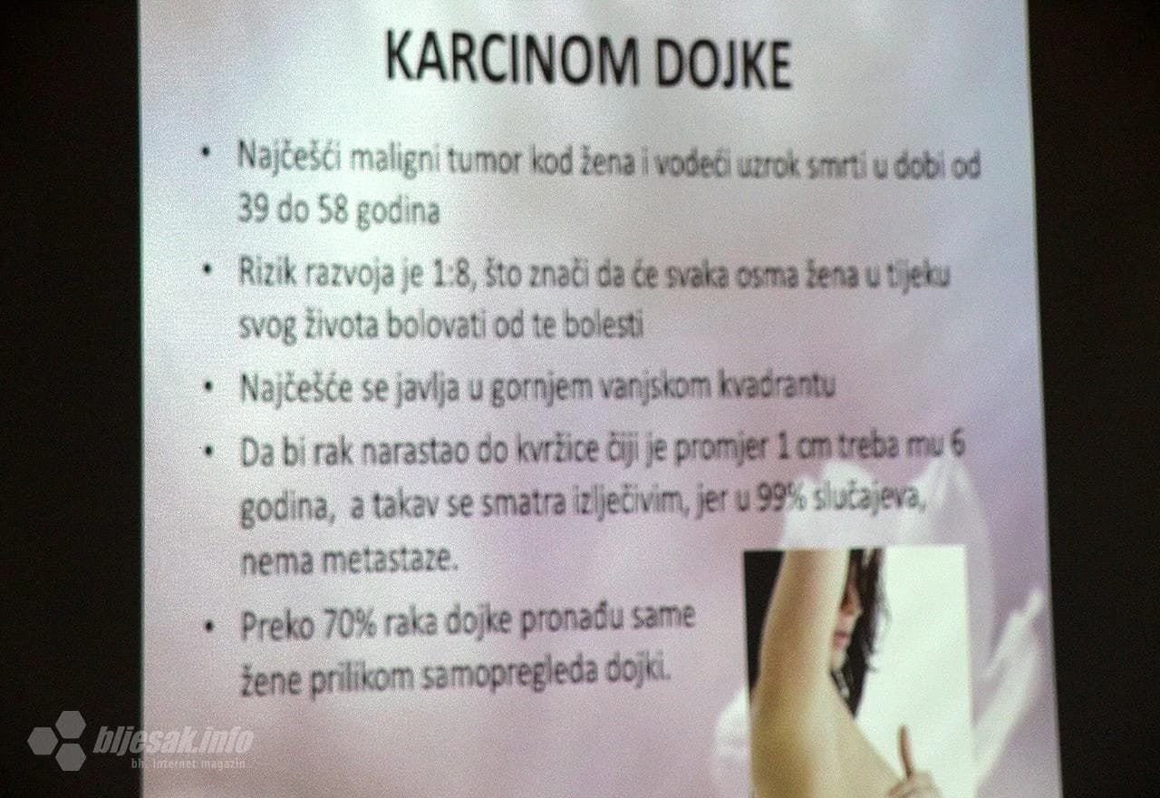 S predavanja o karcinomu dojke