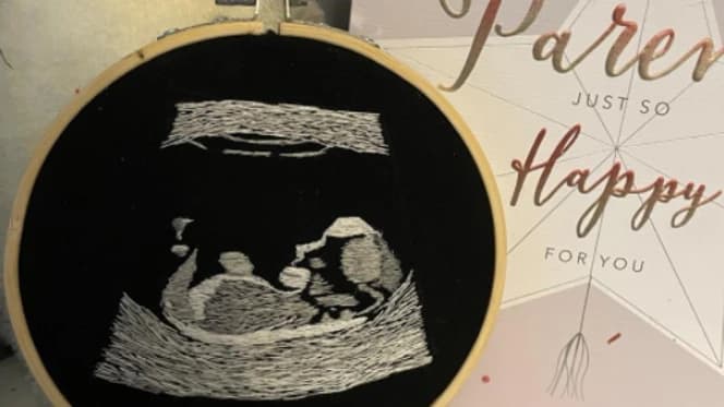 Izvezena slika ultrazvuka