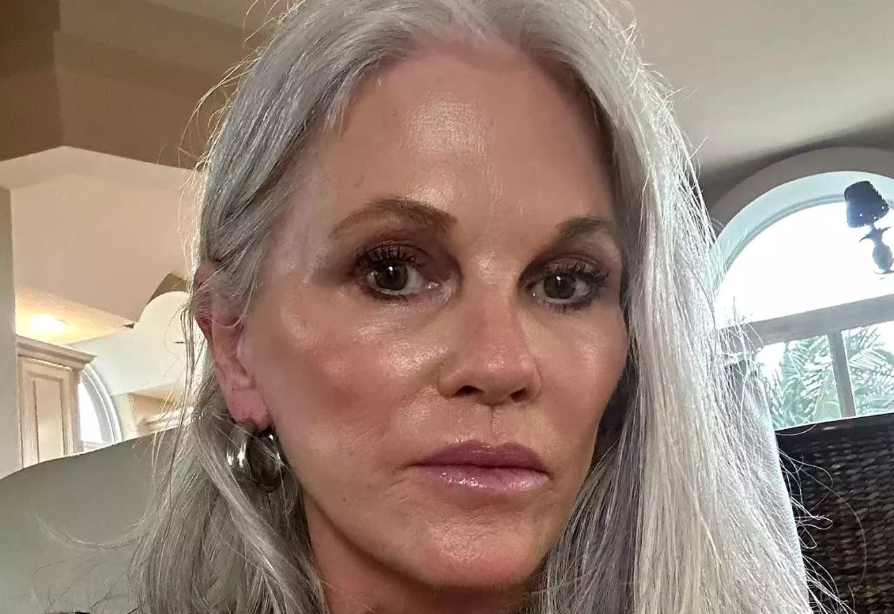 Lisa 6 mjeseci nakon operacije