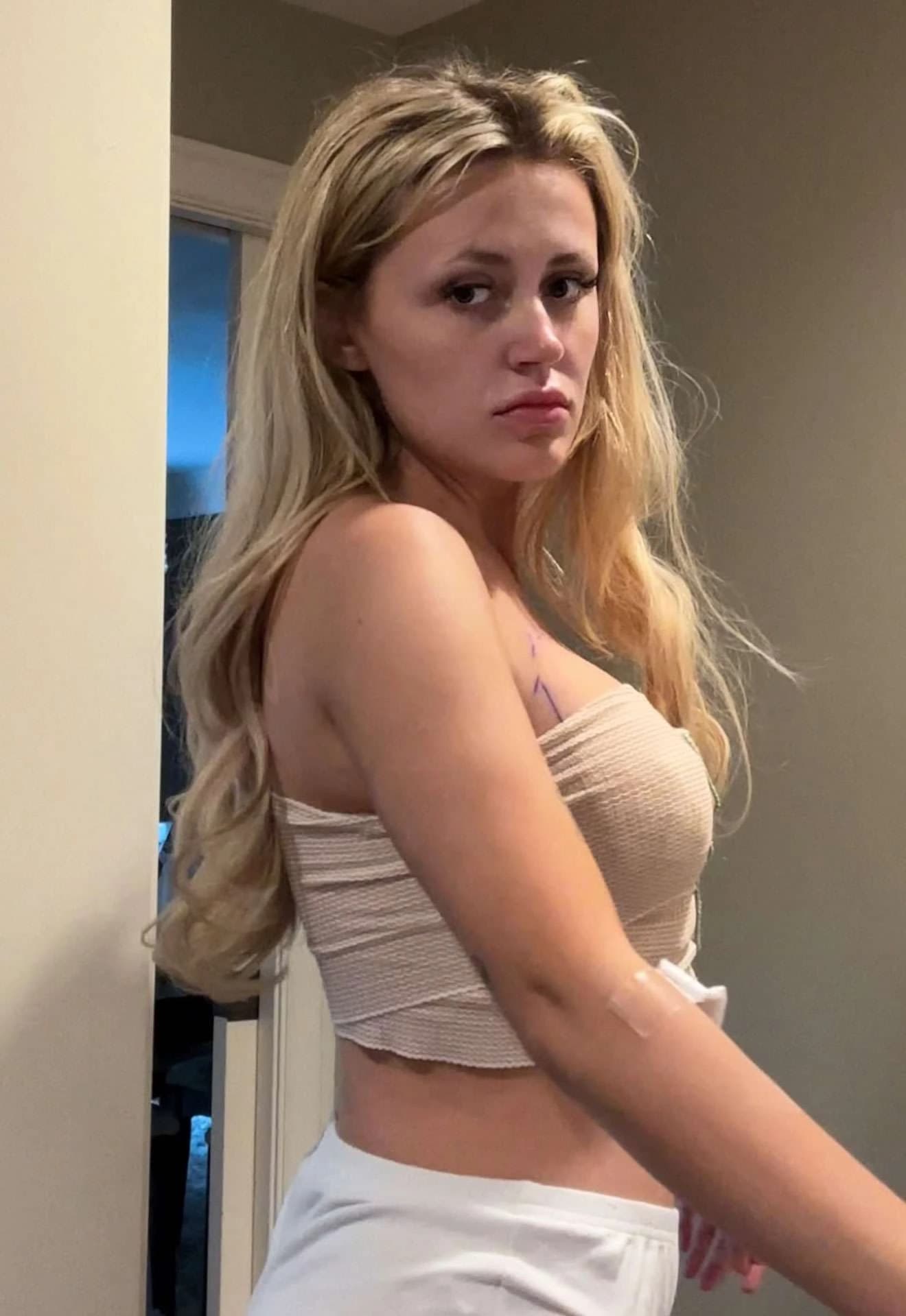 Maddison Steiner nakon operacije