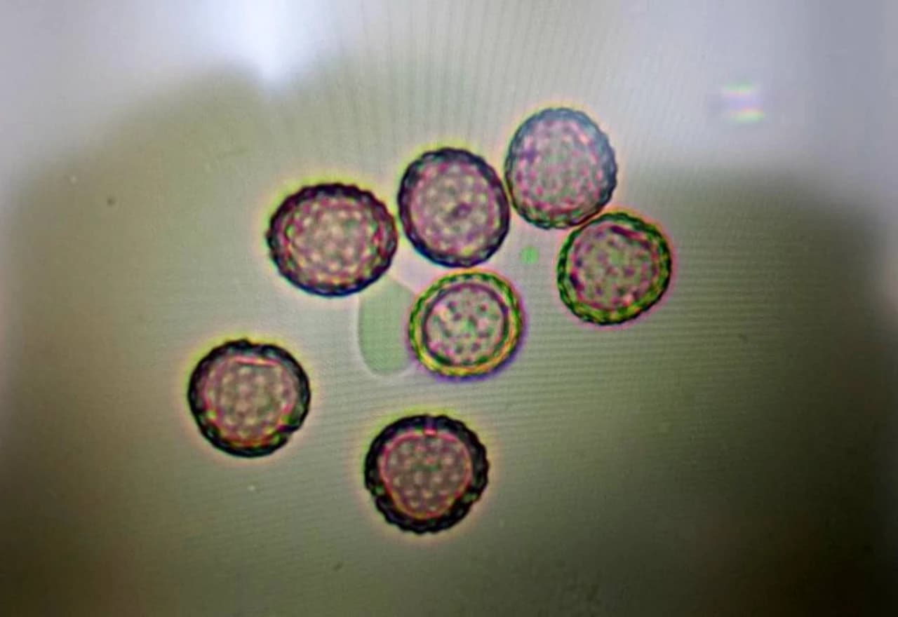 Polenovo zrno pod mikroskopom