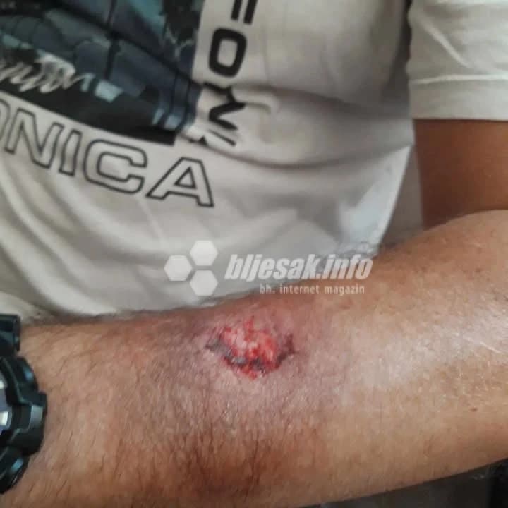 Čitatelj tvrdi kako ga je žena ugrizla