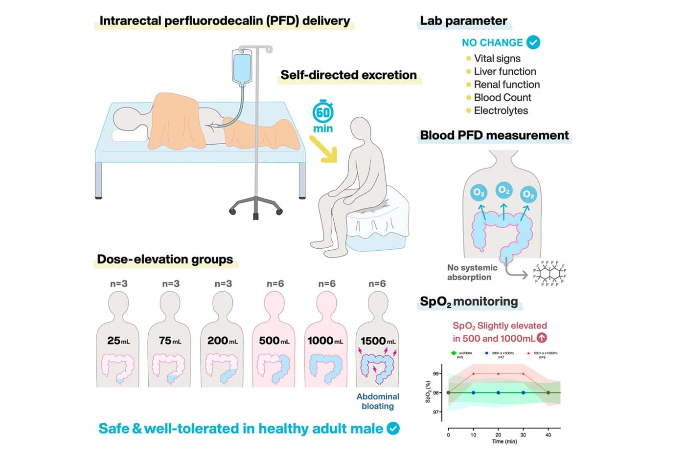 Grafički prikaz istraživanja