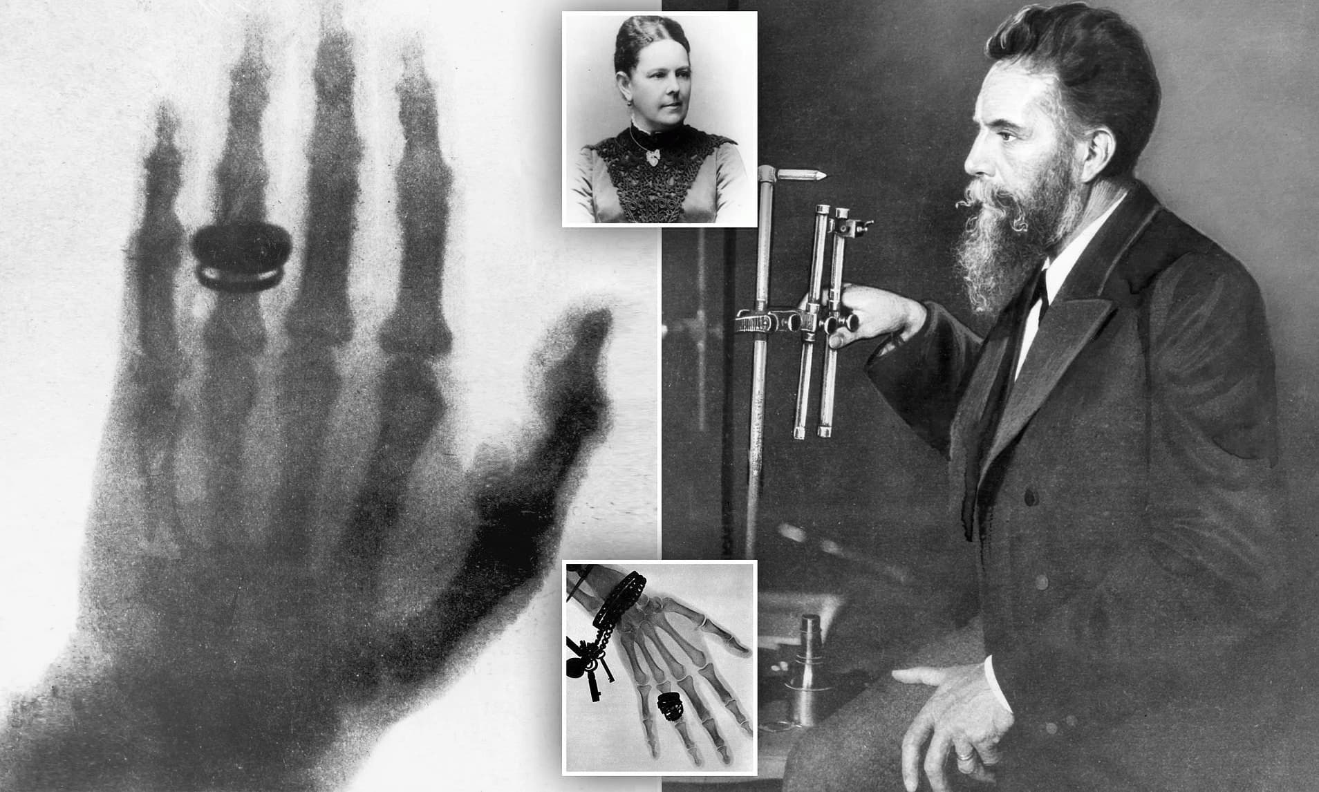 Wilhelm Conrad Röntgen izveo je znanstvenu revoluciju otkrivanjem X-zraka