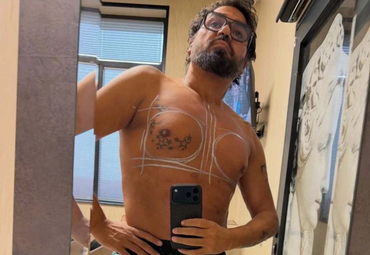 Azis pokazao estetski zahvat