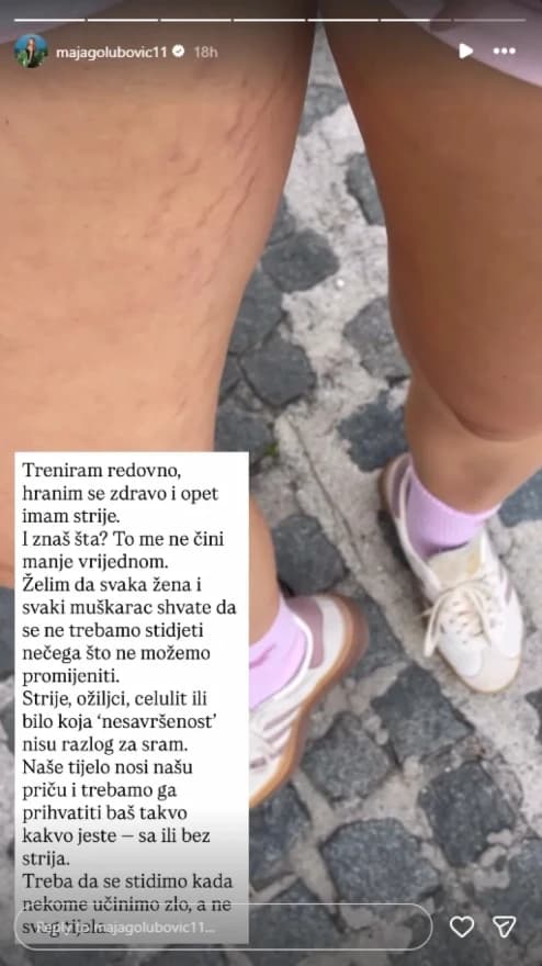 Maja Golubović o strijama na tijelu