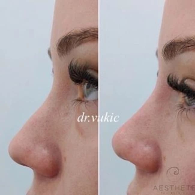 Dolazak vrhunskih plastičnih kirurga u Polikliniku Vitalis