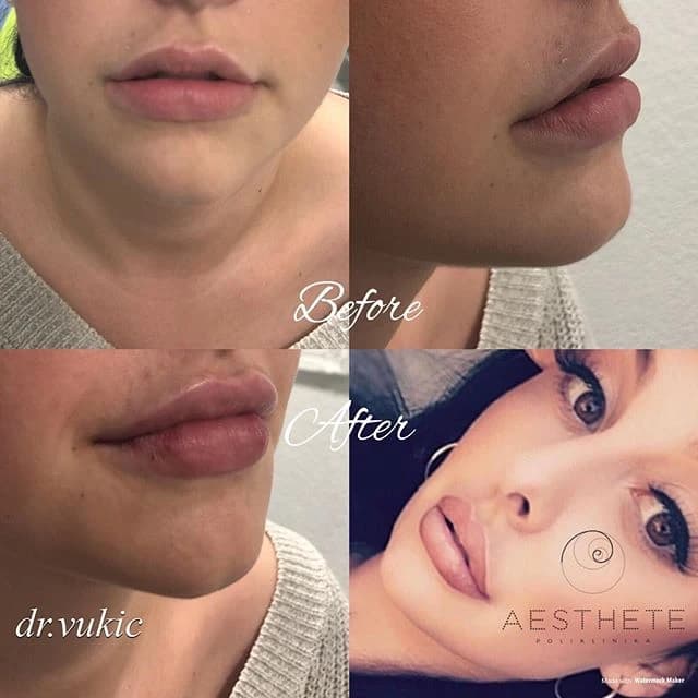 Dolazak vrhunskih plastičnih kirurga u Polikliniku Vitalis